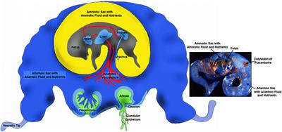 Fructose metabolism is unregulated in cancers and placentae